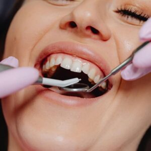 Restorative Dentistry @ Greenacre Dental