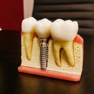 Surgical Dentistry @ Greenacre Dental